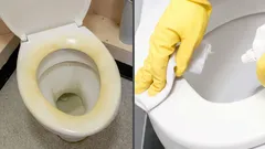 Yellow stains on a toilet seat will disappear in 10 minutes: An effective home remedy